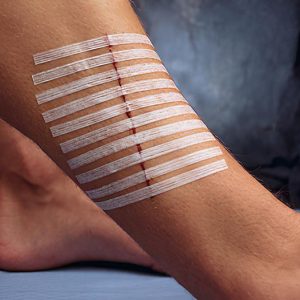 Cerotti Steri-Strip Strisce per Sutura Sterili 100x6 MM DM IS 10 Pezzi - 3