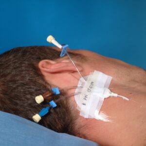 3M Tegaderm I.V. Strips Medicazione Sterile 8,5x10,5 cm Linee Centrali - 100 pz - 3
