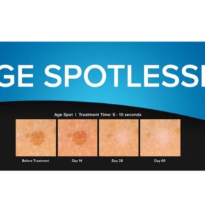 Dispositivo Criochirurgico CryoClear con Cartuccia 16 g Non Ricaricabile - 3
