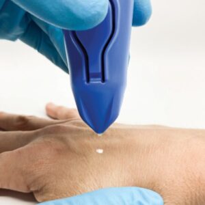 Dispositivo Criochirurgico CryOmega con Cartuccia 16 g Non Ricaricabile - 3