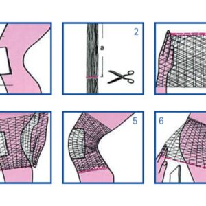 Rete Tubolare Elastica Surgifix Calibro E per Ginocchio e Gamba Latex Free - 20 - 2