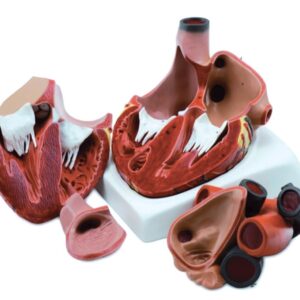 Modello Anatomico Cuore Sezionato 4 Parti Scala 3X - 2