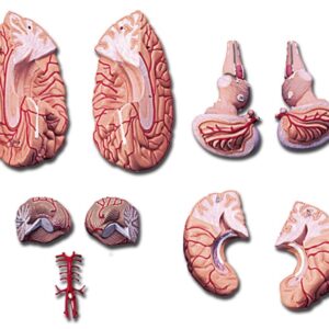 Modello Anatomico Cervello con Arterie 9 Parti Scomponibili - 2