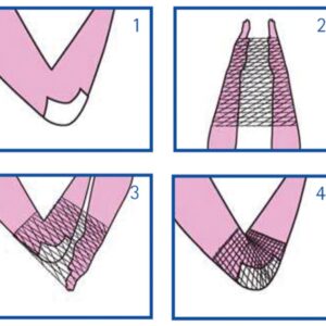 Rete Tubolare Elastica Surgifix Calibro C per Braccio e Spalla Latex Free - 30 p - 2