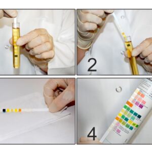 Strisce Urine CombiScreen 9+Leuko Plus 9+1 Parametri con Protezione Acido Ascorb - 2
