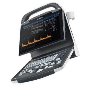 Mindray Ecografo DP-10 B/N con Monitor LED 12,1" e 1 Connettore Sonda - 3