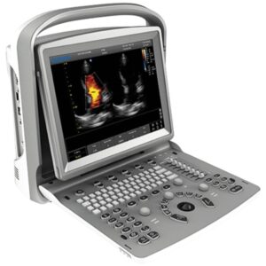 Chison ECO6 Ecografo a Colori con Schermo LED 12" e 2 Connettori Sonda - 1