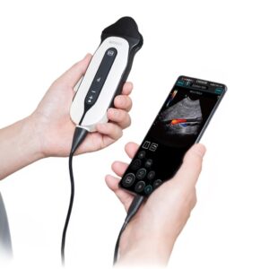 Ecodoppler Portatile Digitale a Colori Sonoeye P6 con Sonda Micro-Convex - 2