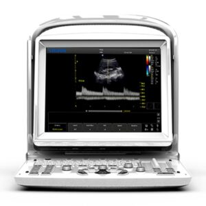 Chison Ecografo B/N ECO3 con Doppler 2 Connettori Sonda - 2
