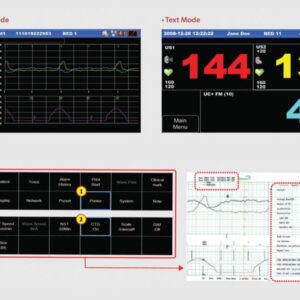 Monitor Fetale Gemellare FC1400 con FHR, UA e FM - 3