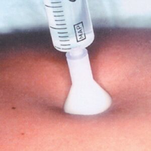 Aghi per Mesoterapia S.I.T. Sterili 31G 0,26x2,5 mm Bianco - 50 pezzi - 2
