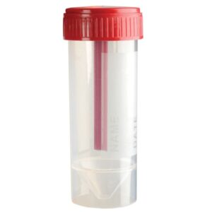 Contenitore Feci Coprotainer 30 ml in Polipropilene con Tappo a Vite Rosso Camer - 1