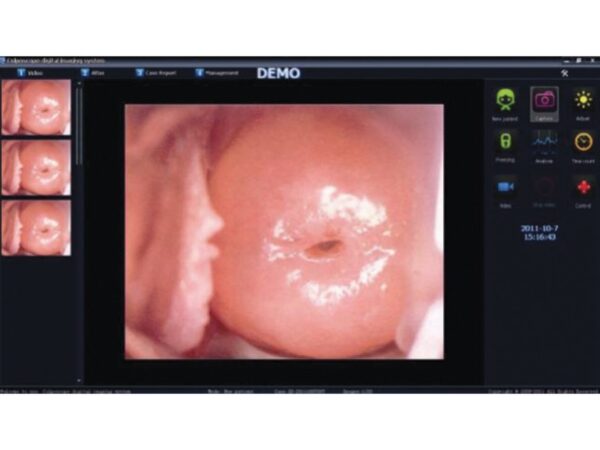 Software per Colposcopia con Scheda HDMI per 29624, 29625, 29628