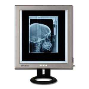 Negativoscopio Ultrapiatto da Tavolo LED 42x36 cm