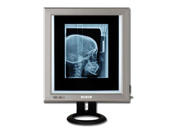 Negativoscopio Ultrapiatto da Tavolo LED 42x36 cm