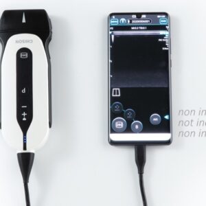 Sonoeye P2 Ecodoppler Portatile Digitale a Colori con Sonda Linear Array - 2