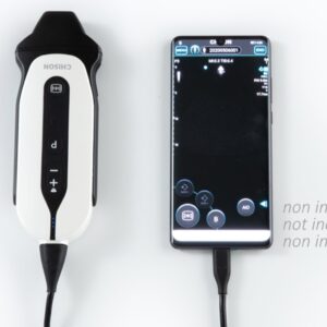 Ecodoppler Portatile Sonoeye P3 Digitale a Colori con Sonda Phase Array - 2