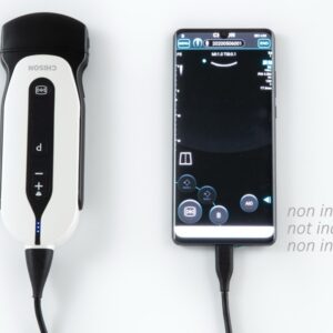 Ecodoppler Portatile SONOEYE P5 Digitale a Colori con Sonda Convex - 2