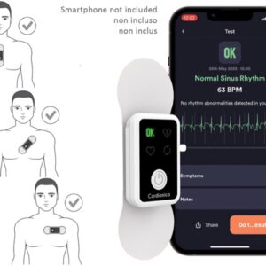 Elettrocardiografo Cardionica a 1 Canale con Rilevamento AFib e Bluetooth 4.0 - 2